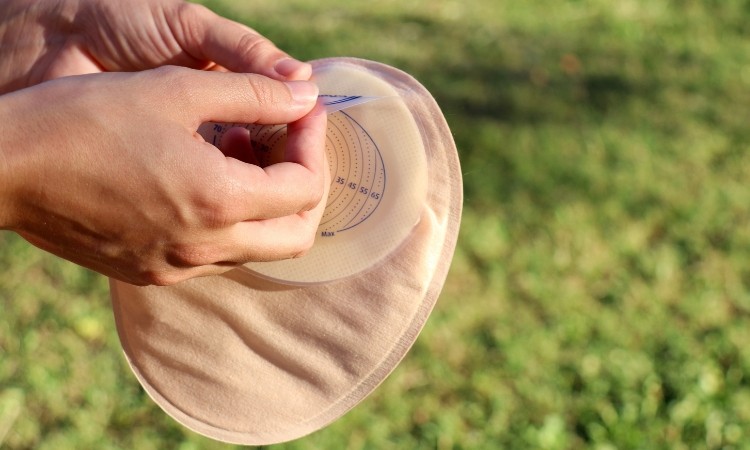 What if we could improve the quality of life for patients with ostomy bags?