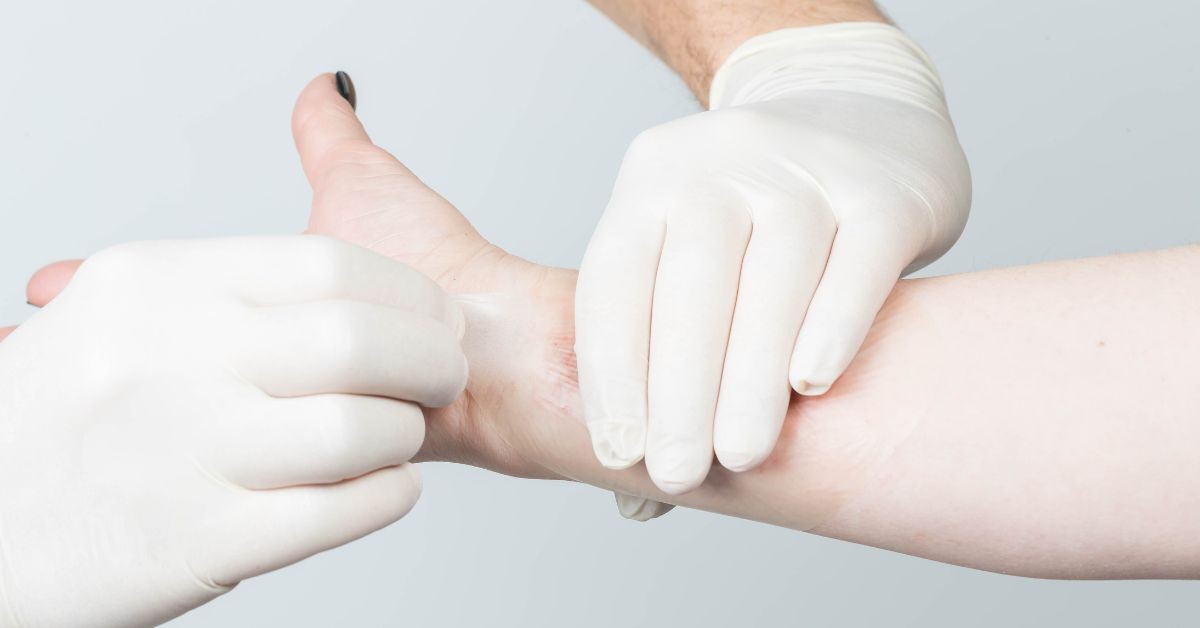 Close-up of TASA wound care, clinician applying treatment to wrist injury.